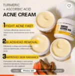 Acne Cream - Image 2