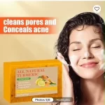 Clean Pores & Conceal Acne All Naturals Turmeric Soap Bar
